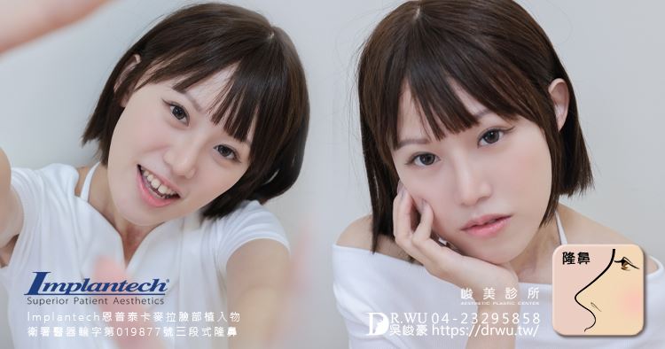 【 三段式隆鼻】 精緻挺鼻，弱化月亮臉型! ｜卡麥拉臉部植入物｜台中隆鼻｜隆鼻手術｜