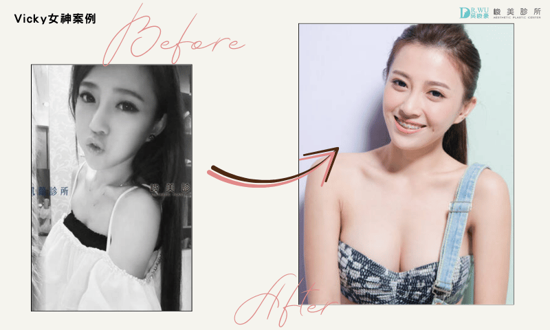 圖片來源：峻美Vicky女神案例