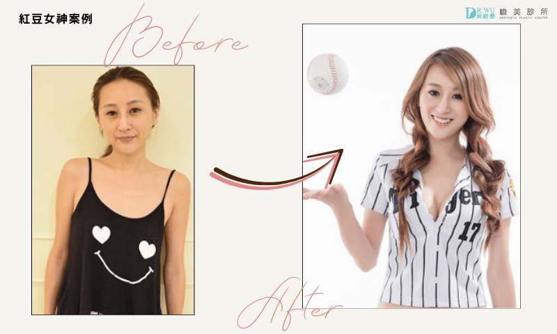 圖片來源：峻美紅豆女神案例