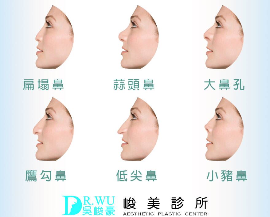 6種常見的鼻型困擾與條件分析