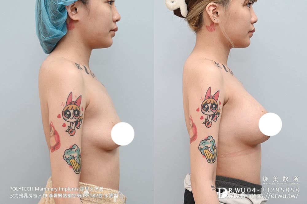 ＂隆乳＂小文女神案-女神波隆乳