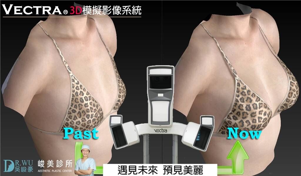峻美診所VECTRA 3D模擬影像系統
