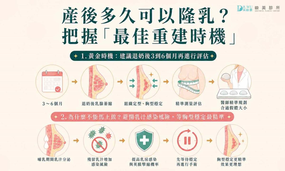 產後多久可以隆乳?建議退奶後3到6個月為產後隆乳推薦黃金時機