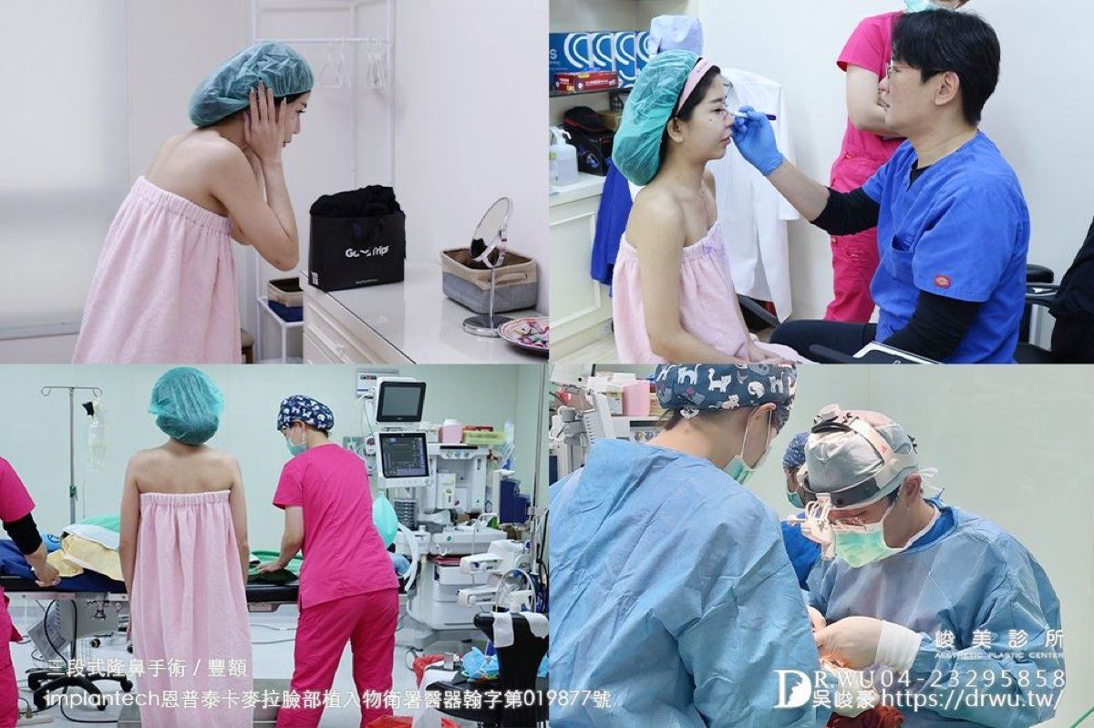 隆鼻重修手術流程｜瑜瑜術前準備與手術過程