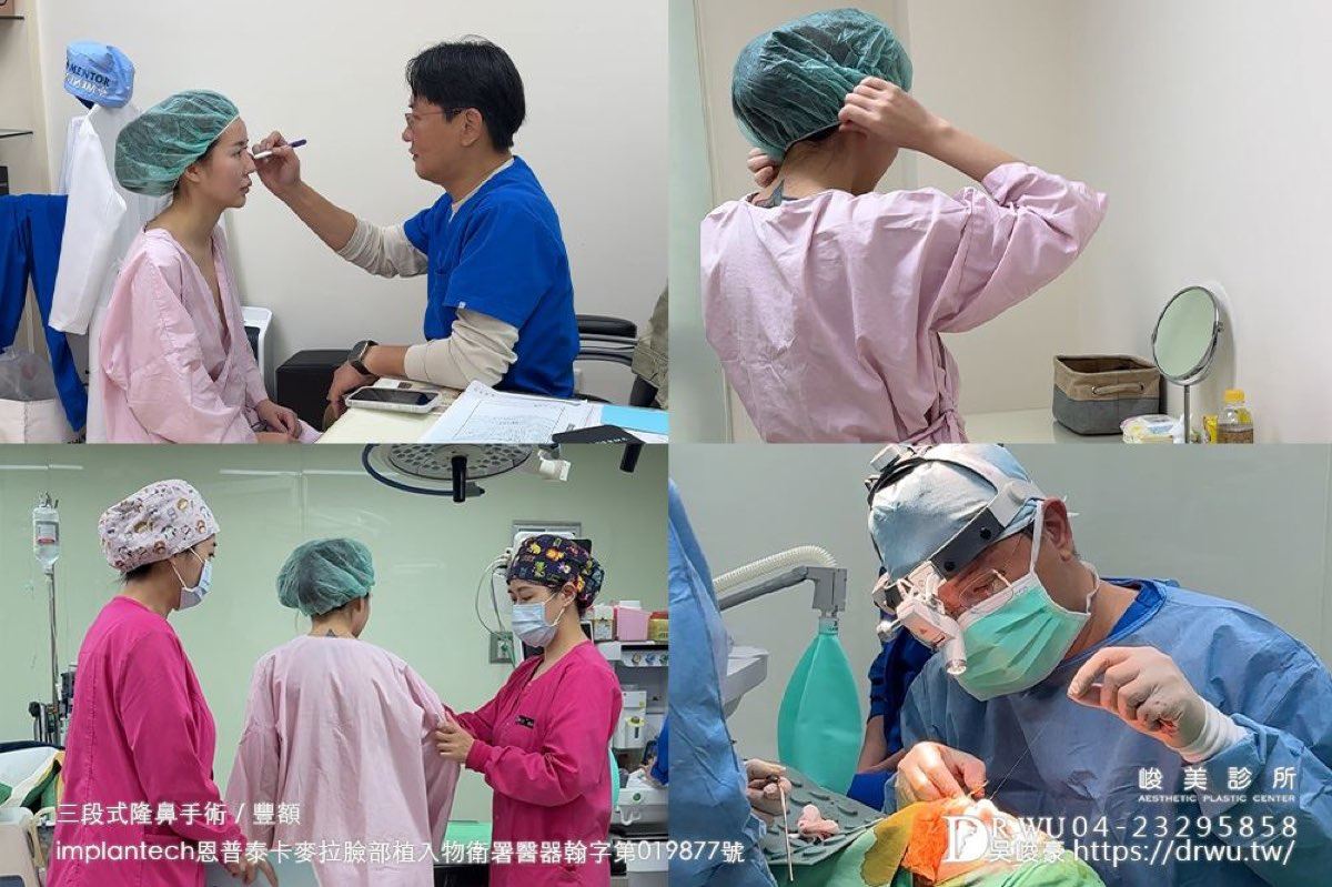 隆鼻重修案例｜其其第四次重修手術過程