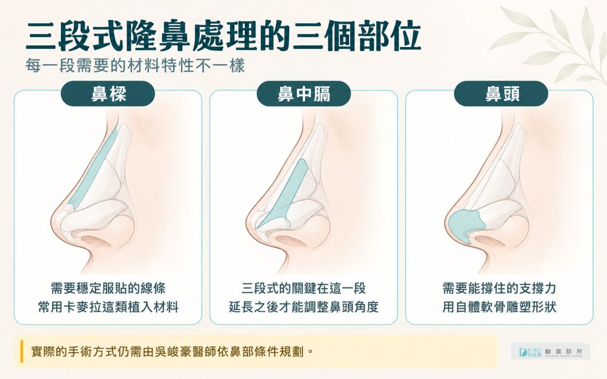 在峻美,三段式是方法,自體肋軟骨是材料