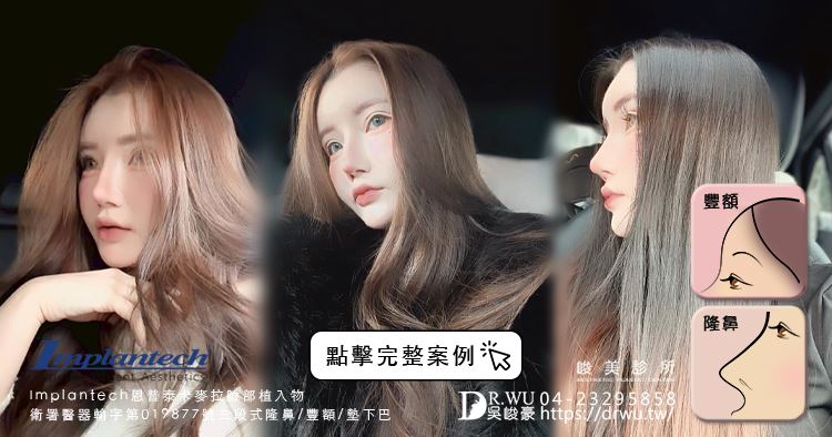 【豐額+隆鼻】肉鼻頭改善，打造微翹肋骨網美鼻！｜卡麥拉臉部植入物｜自體肋骨隆鼻｜台中隆鼻｜吳峻豪醫生｜