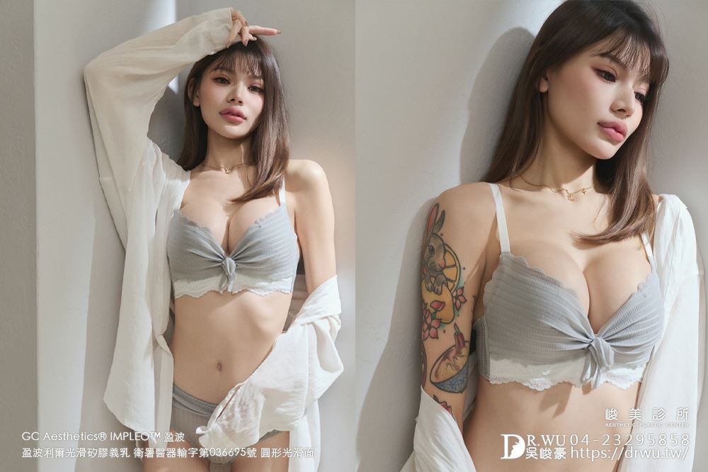 『盈波隆乳』 纖瘦女孩隆乳重修，打造飽滿芭比身材! ｜免按摩隆乳｜光滑面隆乳｜隆乳重修｜