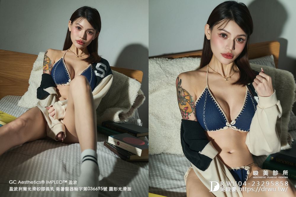 『盈波隆乳』 纖瘦女孩隆乳重修，打造飽滿芭比身材! ｜免按摩隆乳｜光滑面隆乳｜隆乳重修｜