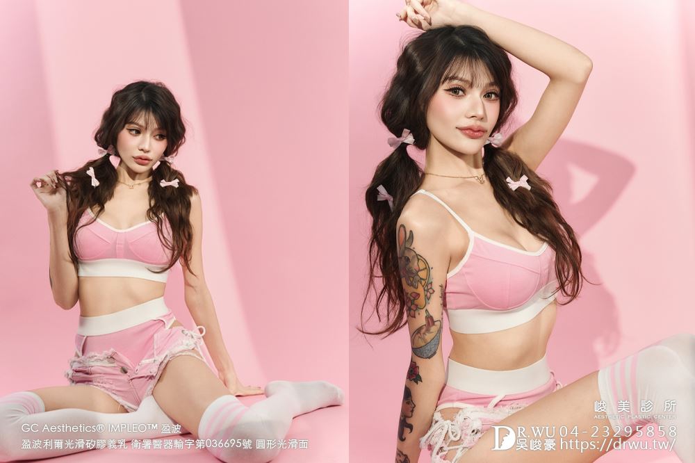 『盈波隆乳』 纖瘦女孩隆乳重修，打造飽滿芭比身材! ｜免按摩隆乳｜光滑面隆乳｜隆乳重修｜