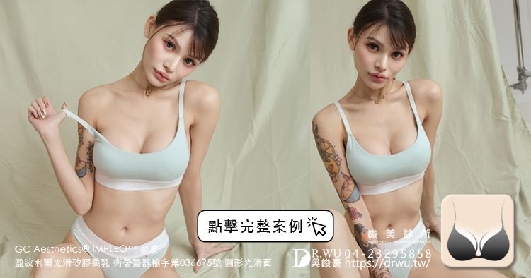 『盈波隆乳』 纖瘦女孩隆乳重修，打造飽滿芭比身材!  ｜隆乳材質｜台中隆乳｜