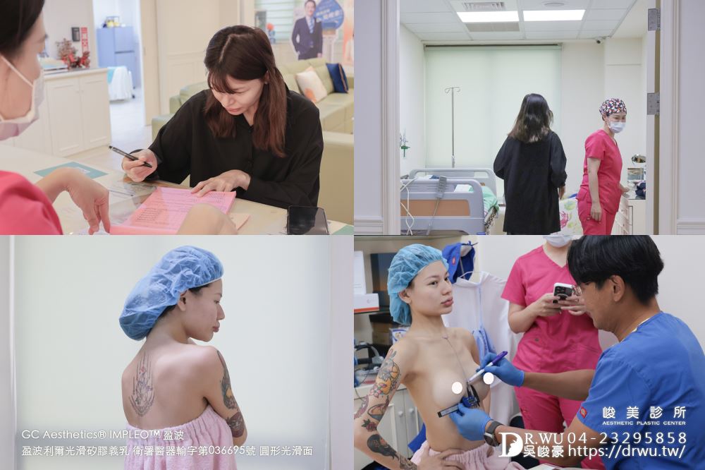 『盈波隆乳』 纖瘦女孩隆乳重修，打造飽滿芭比身材! ｜免按摩隆乳｜光滑面隆乳｜隆乳重修｜