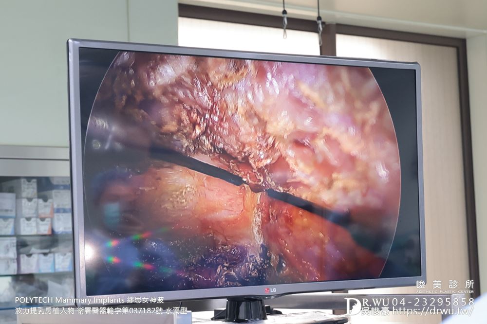 吳峻豪醫生， 第二屆繆思女神波示範教學圓滿結束 !