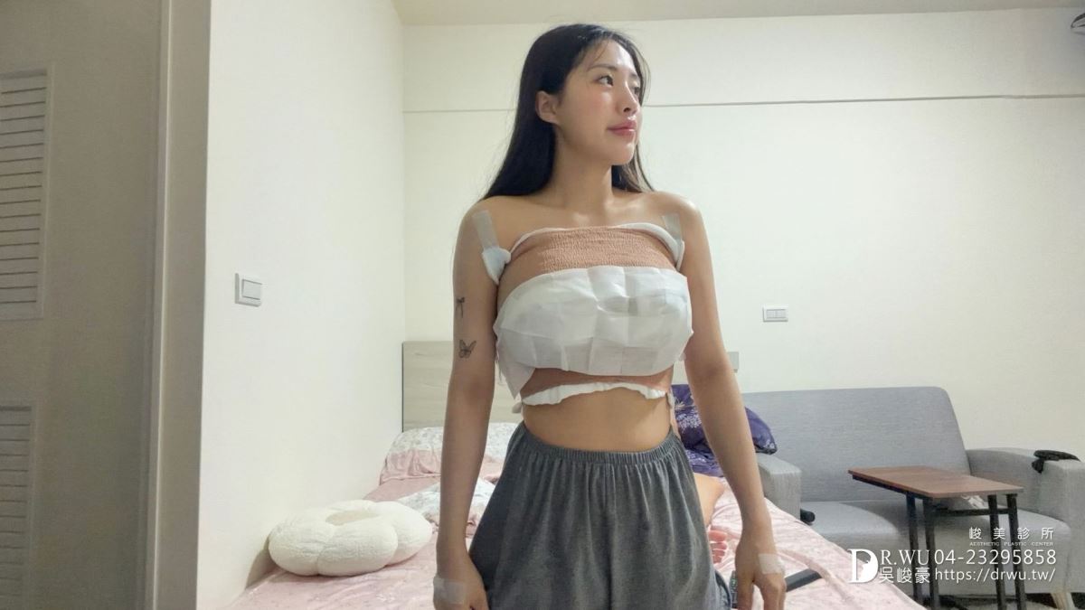 『女王波隆乳』送自己人生大禮，峻美診所圓夢美胸｜女王波隆乳材質｜台中隆乳｜